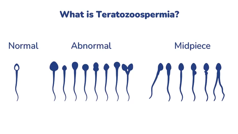 Asthenoteratozoospermia Illustration